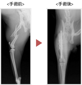 大腿骨骨折の症例