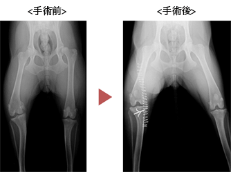 膝蓋骨脱臼の症例