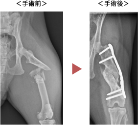 大腿骨骨折の症例